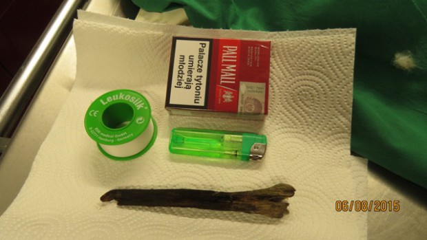 Ursache des Leidens des Adlers (Foto: Naturpark)